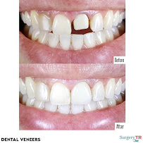 Surgery TR - Plastic Surgery & Hair Transplantation & Cosmetic Dentistry (Head Office)