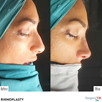 Surgery TR - Plastic Surgery & Hair Transplantation & Cosmetic Dentistry (Head Office)