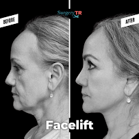 Surgery TR - Plastic Surgery & Hair Transplantation & Cosmetic Dentistry (Head Office)
