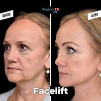 Surgery TR - Plastic Surgery & Hair Transplantation & Cosmetic Dentistry (Head Office)