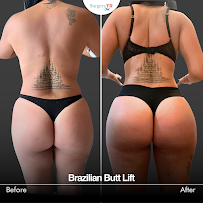 Surgery TR - Plastic Surgery & Hair Transplantation & Cosmetic Dentistry (Head Office)