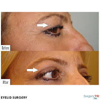 Surgery TR - Plastic Surgery & Hair Transplantation & Cosmetic Dentistry (Head Office)