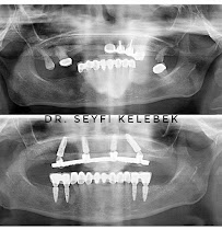 Dr. Dt. Seyfi Kelebek