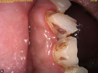 Bright Dental Care