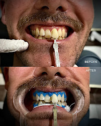 Bali Dental Assistance