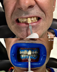 Bali Dental Assistance