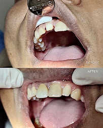 Bali Dental Assistance