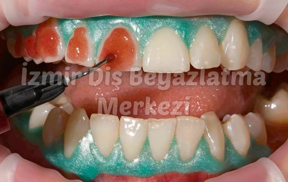 Zmir Alsancak Di Klinii dental clinic