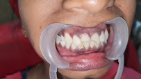 Mount Multispeciality Dental Clinic St.Thomas Mount