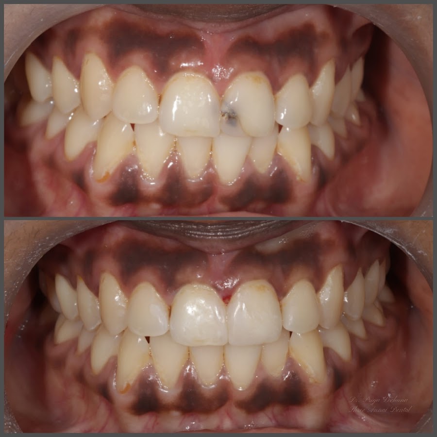 Shree Annai Dental Clinic dental clinic