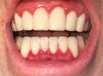 All On Dental Istanbul