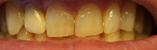 All On Dental Istanbul