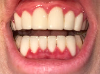 All On Dental Istanbul