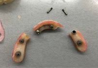 All On Dental Istanbul
