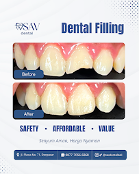 SAV Dental Bali