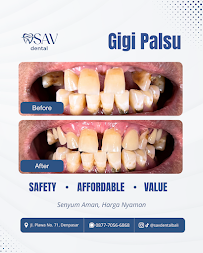 SAV Dental Bali