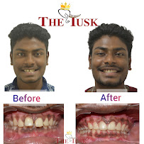 The Tusk Multispeciality Dental Clinic & Orthodontic centre (Invisalign )Classic Edition - Park town