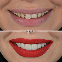 Perla Oral and Maxillofacial Clinic