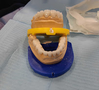 Diamond Dental Antalya | Diş Hekimi - Diş Polikliniği | Implant, Veneer, Crowns Dentist
