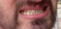Dental Clinic Antalya