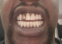 Dental Clinic Antalya