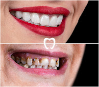 Dental Clinic Antalya