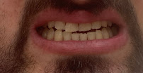 Dental Clinic Antalya