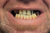 Dental Clinic Antalya