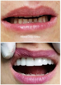 Dental Clinic Antalya