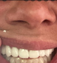 Dental Clinic Antalya