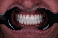 Antalya Akdeniz Dental Clinic