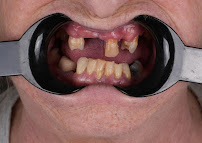 Dentatur Dental Health Clinics