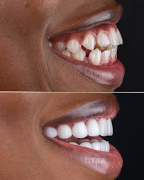 Myra Dental Centre Turkey (Veneers Turkey, Crowns Turkey, Dental Implants Turkey, Dentist Turkey, Teeth Whitening)