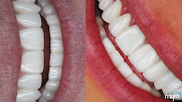 Myra Dental Centre Turkey (Veneers Turkey, Crowns Turkey, Dental Implants Turkey, Dentist Turkey, Teeth Whitening)