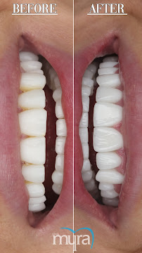 Myra Dental Centre Turkey (Veneers Turkey, Crowns Turkey, Dental Implants Turkey, Dentist Turkey, Teeth Whitening)