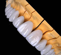 Myra Dental Centre Turkey (Veneers Turkey, Crowns Turkey, Dental Implants Turkey, Dentist Turkey, Teeth Whitening)