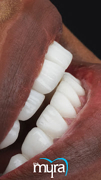 Myra Dental Centre Turkey (Veneers Turkey, Crowns Turkey, Dental Implants Turkey, Dentist Turkey, Teeth Whitening)