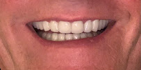 Antlara Dental Clinic | Antlara Ağız ve Diş Sağlığı Polikliniği