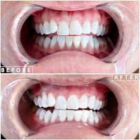 Lara Smile Dental Clinic Turkey