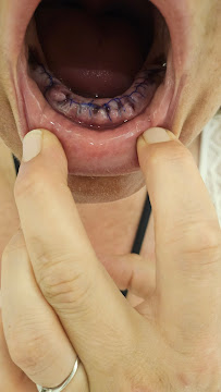 Lara Smile Dental Clinic Turkey