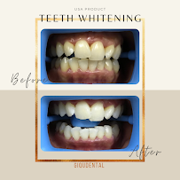 Giqu Dental Canggu