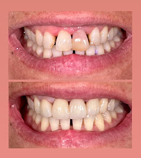 Giqu Dental Canggu
