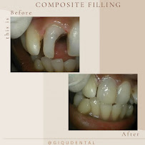 Giqu Dental Canggu