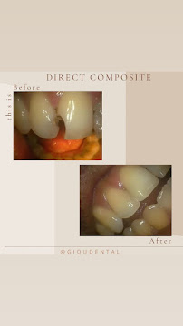 Giqu Dental Canggu