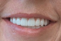 Dentakay Dental Clinic Antalya