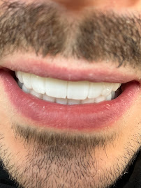 Dentakay Dental Clinic Antalya