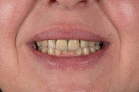 Medic Antalya Dental Clinic