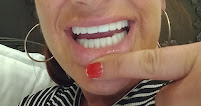 Smile Center Turkey® (Dentist in Antalya | Dental Veneers | Hollywood Smile | Smile Makeover | E-Max Laminate Veneers)