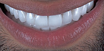 DentAntalya (Oral & Dental Health Clinic)
