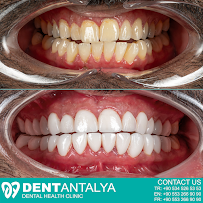 DentAntalya (Oral & Dental Health Clinic)